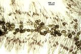 Tallo endofita in Dudresnaya verticillata (Withering) Le Jolis
